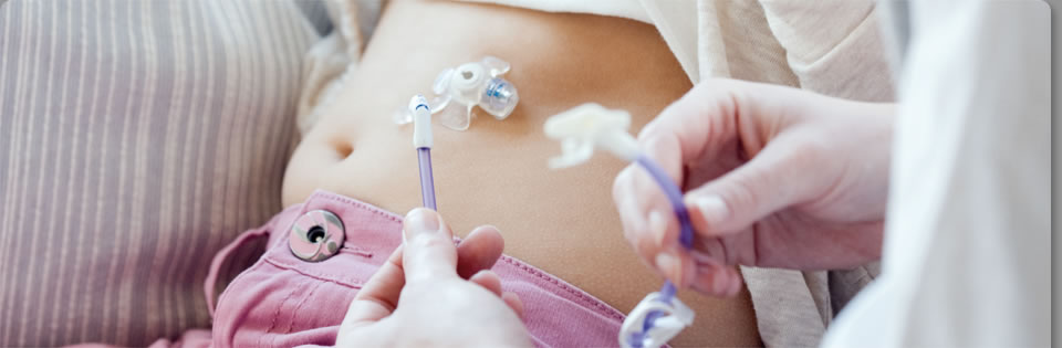 گاستروستومی اندوسکوپیک: راهکاری برای تغذیه بیماران خاص