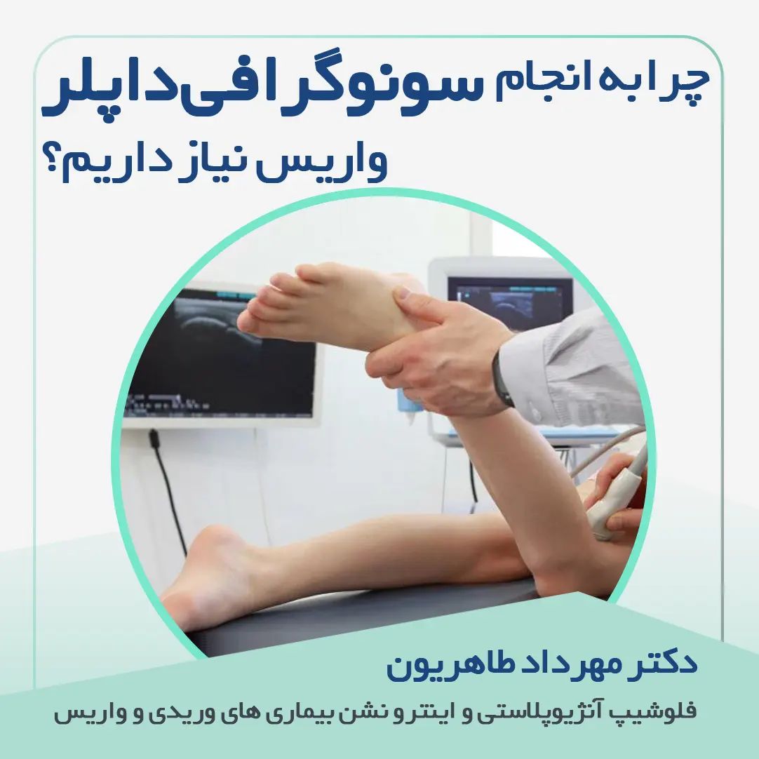 چرا به انجام سونوگرافی داپلر برای واریس نیاز داریم؟