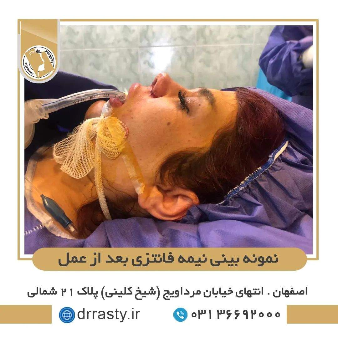 عمل بینی نیمه فانتزی