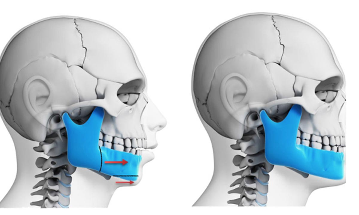 جراحی تخصصی فک