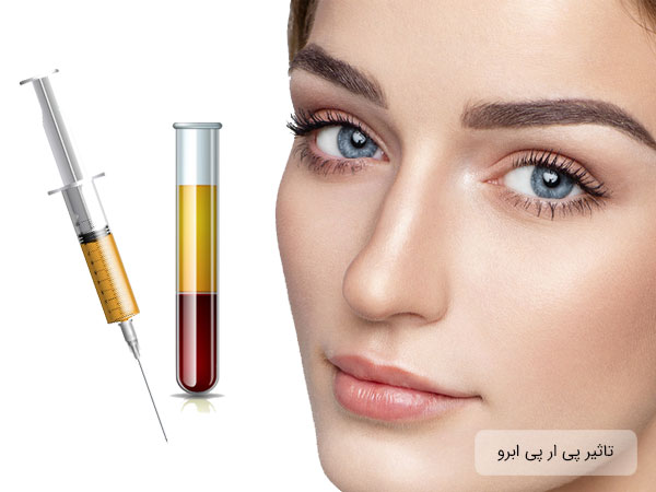 پی ار پی ابرو